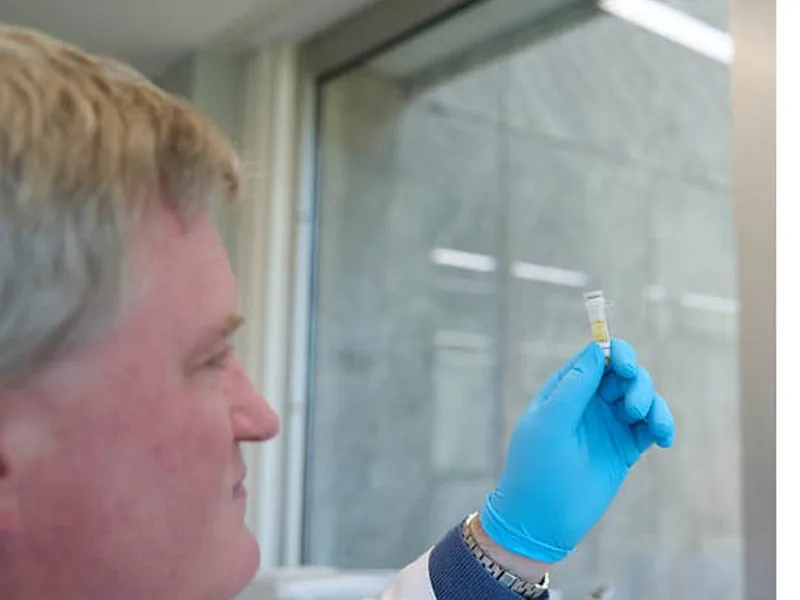 Laboratorium analyseert de SOA test bij microbe&lab voor Rotterdam